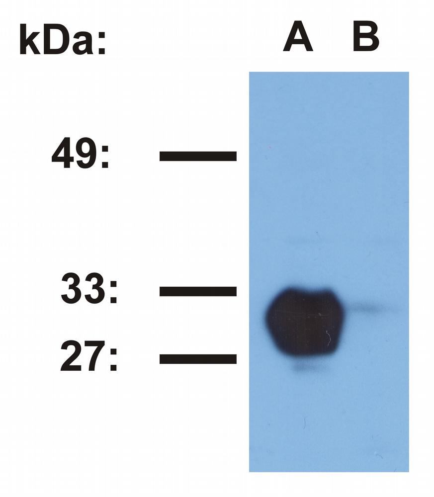 Anti-HLA-DR1 (empty) Monoclonal Antibody (Clone:MEM-267)