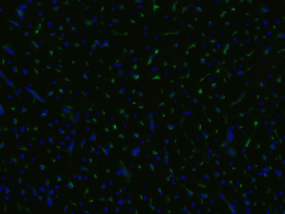 Anti-CD105 / Endoglin Monoclonal Antibody (Clone:MEM-229)