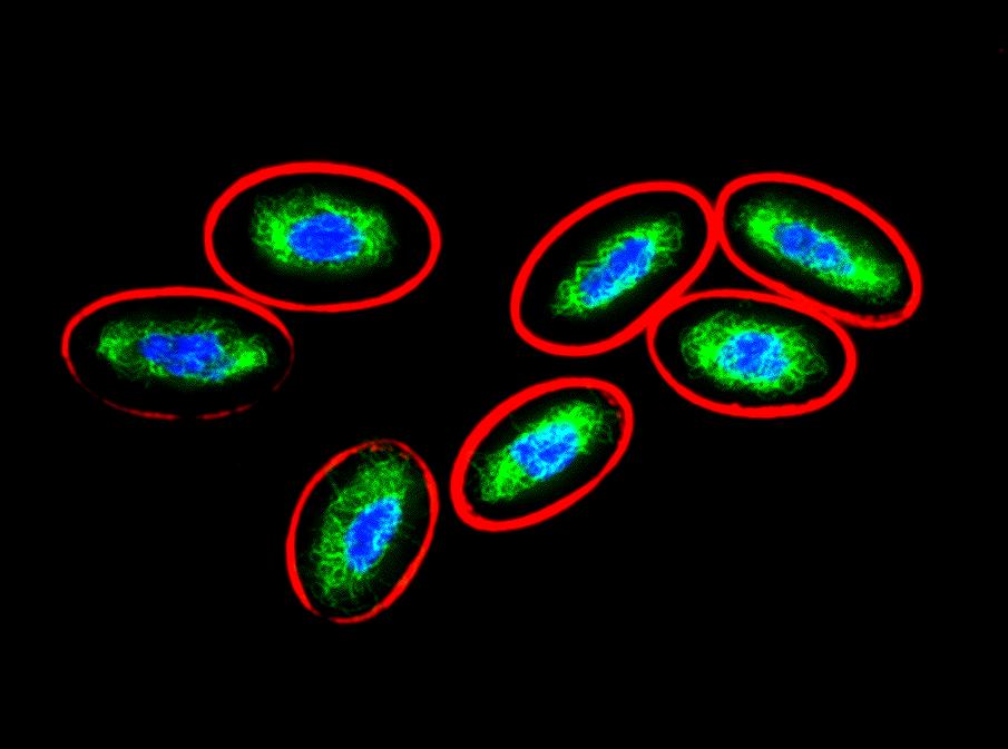 Anti-Vimentin Monoclonal Antibody (Clone:VI-10)