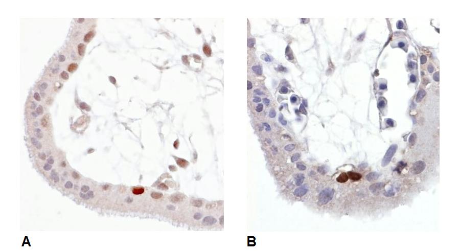 Anti-p53 (Phospho-Ser392) Monoclonal Antibody (Clone:FP3.2 [FPS392])