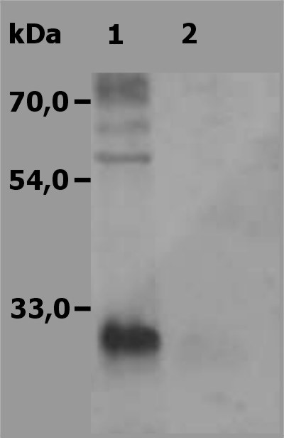 Anti-NTAL / LAB Polyclonal Antibody(Discontinued)