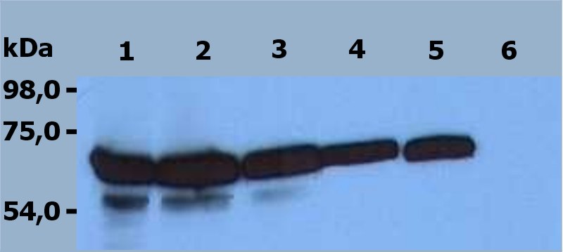 Anti-ZAP-70 Monoclonal Antibody (Clone:ZAP-03)