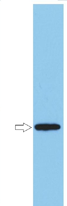 Anti-Neisseria meningitidis antigen Orf1 / FrpD Polyclonal Antibody