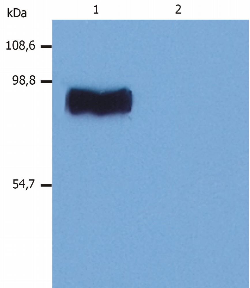 Anti-STIM1 / GOK Monoclonal Antibody (Clone:CDN3H4)