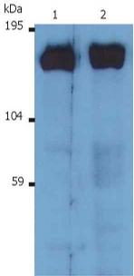 Anti-Sos Monoclonal Antibody (Clone:SOS-01)