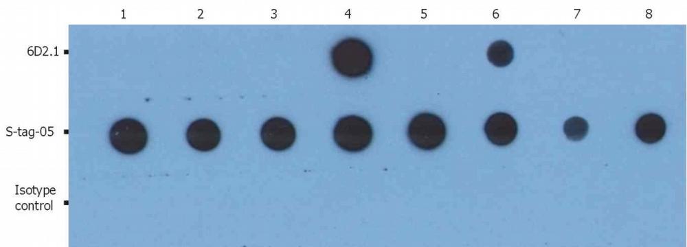 Anti-PKAc Monoclonal Antibody (Clone:6D2.1)