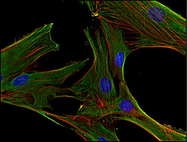 Anti-Clathrin heavy chain Monoclonal Antibody (Clone:BF-06)