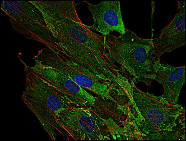 Anti-AHNAK1 Monoclonal Antibody (Clone:EM-09)