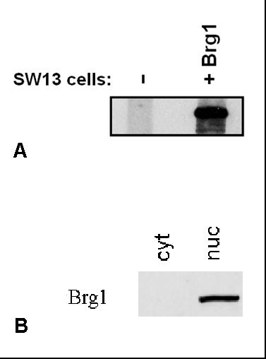 Anti-Brg1 Monoclonal Antibody (Clone:BRG-01)