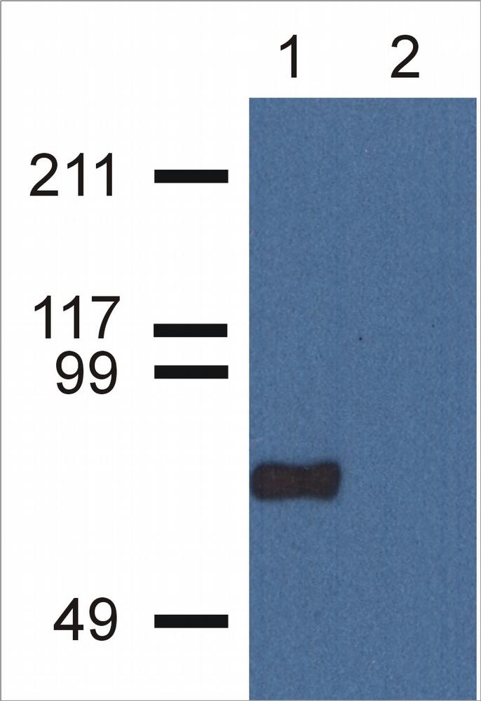 Anti-CPNE7 Monoclonal Antibody (Clone:CPNE7-01)