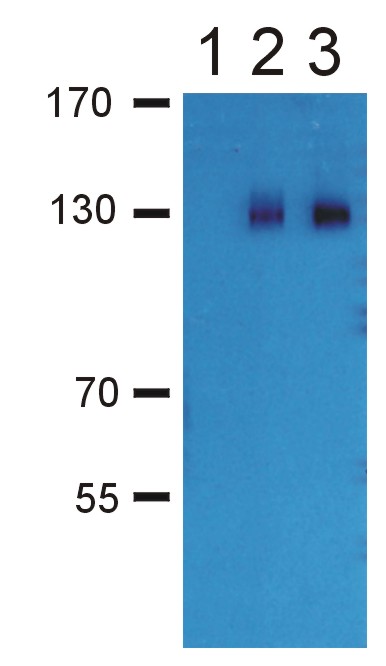 Anti-GABA B receptor GB2 subunit Polyclonal Antibody(Discontinued)