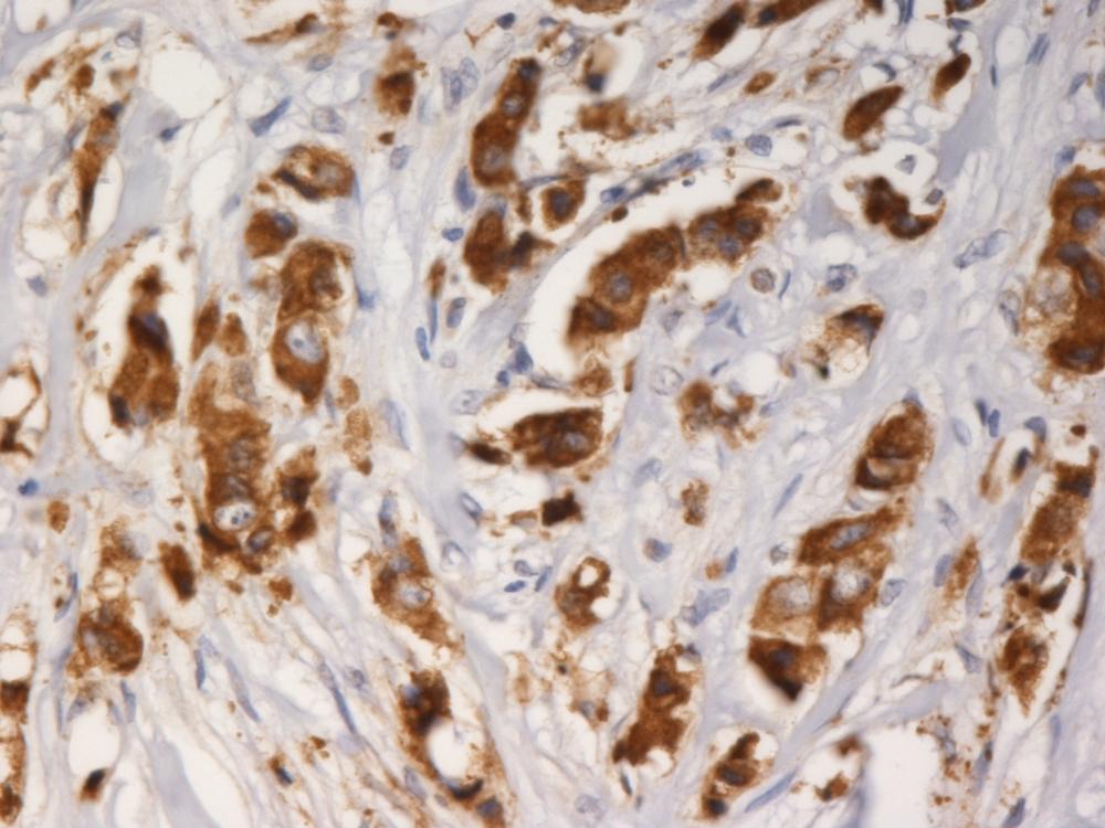 Anti-AGR3 Monoclonal Antibody (Clone:AGR3.1)