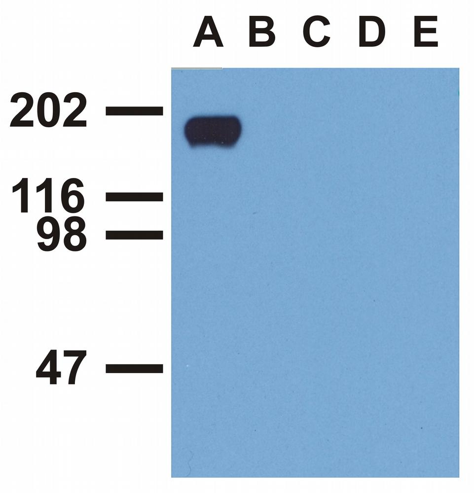 Anti-EGFR (Phospho-Tyr992) Monoclonal Antibody (Clone:EM-12)