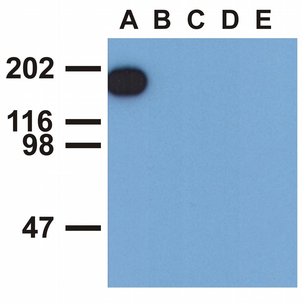 Anti-EGFR (Phospho-Tyr1173) Monoclonal Antibody (Clone:EM-13)