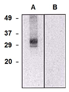 Anti-CLIC5a Monoclonal Antibody (Clone:CLIC5-02)