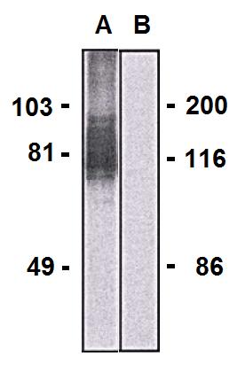 Anti-LARGE1 Monoclonal Antibody (Clone:LARGE-02)