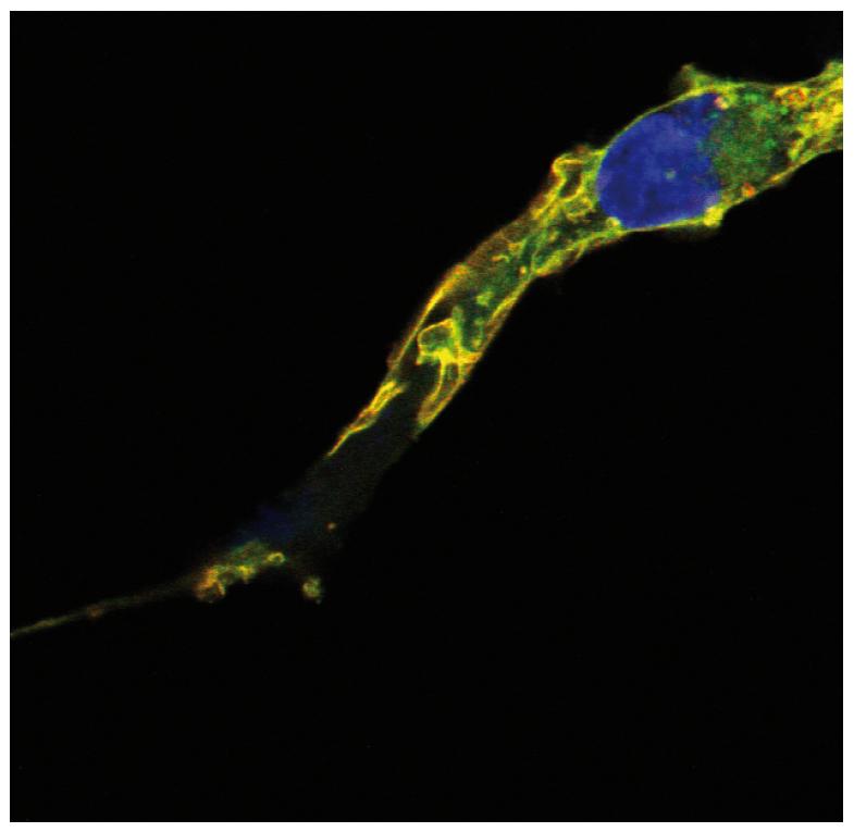 Anti-R-Ras2 / TC21 Monoclonal Antibody (Clone:EM-50)