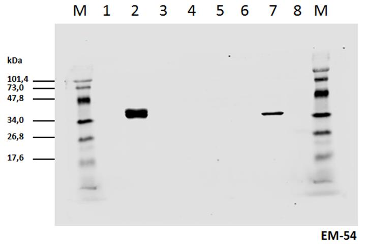 Anti-CD3 zeta (Phospho-Tyr142) Monoclonal Antibody (Clone:EM-54)