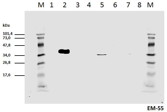 Anti-CD3 zeta (Phospho-Tyr111) Monoclonal Antibody (Clone:EM-55)