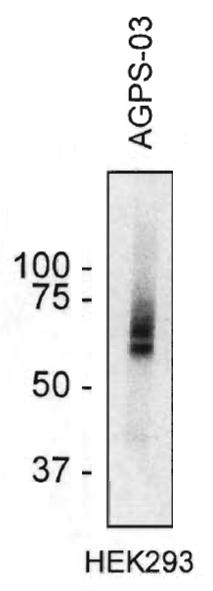 Anti-AGPS Monoclonal Antibody (Clone: AGPS-03) Purified