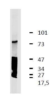 Anti-GARP / LRRC32 Monoclonal Antibody (Clone:GARP5)