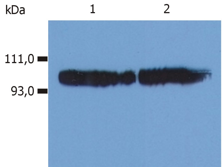 Anti-CD18 / Integrin beta2 subunit Monoclonal Antibody (Clone:MEM-48)-Low Endotoxin