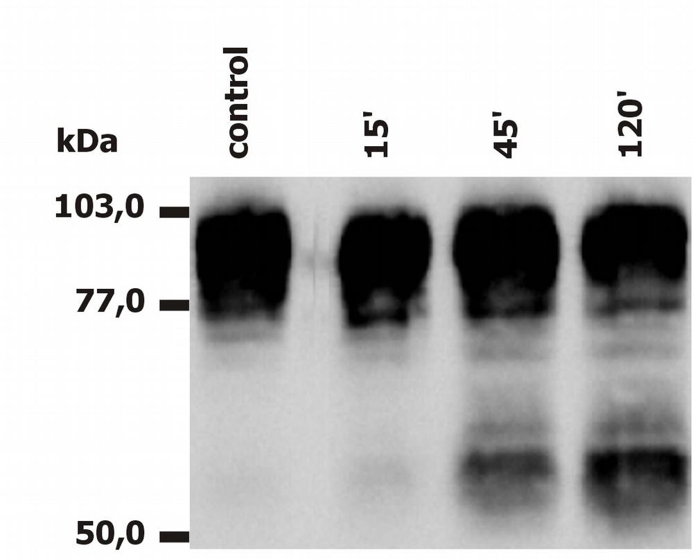 Anti-CD18 / Integrin beta2 subunit Monoclonal Antibody (Clone:MEM-148)-Low Endotoxin