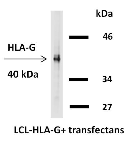 Biotin Conjugated Anti-HLA-G Monoclonal Antibody (Clone:4H84)(Discontinued)