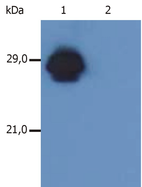 FITC Conjugated Anti-HLA-DR+DP Monoclonal Antibody (Clone:MEM-136)