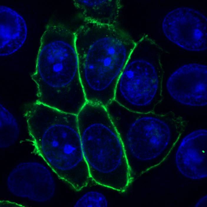 Anti-CD358 / DR6 / TNFRSF21 Monoclonal Antibody (Clone:DR-6-04-EC)-FITC Conjugated(Discontinued)