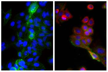 Goat Anti-Mouse IgG2b, Human ads-TRITC