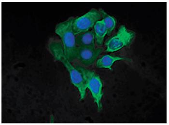 Mouse Anti-Cytokeratin 8-FITC