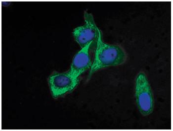 Mouse Anti-Cytokeratin 18-FITC