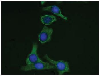 Mouse Anti-Cytokeratin 19-FITC