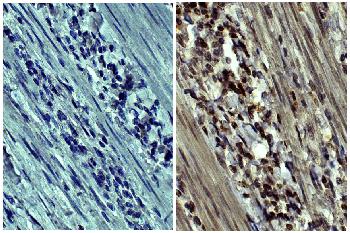 Mouse Anti-Human MMP-9-HRP Conjugated