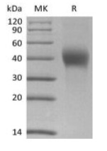 Recombinant Human Dickkopf-Related Protein 1/DKK-1 (C-6His)