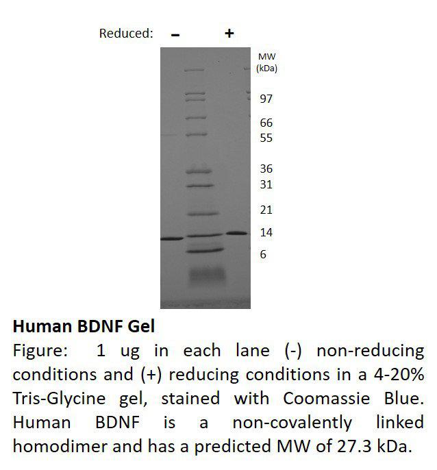 Human Brain Derived Neurotrophic Factor