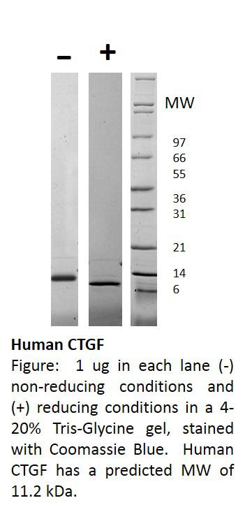 Human Connective Tissue Growth Factor