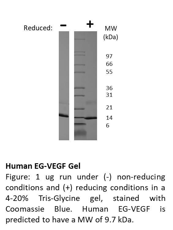 Human Endocrine Gland-Vascular Endothelial Growth Factor