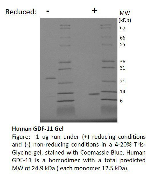 Human Growth and Differentiation Factor-11