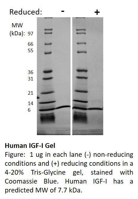 Human Insulin-like Growth Factor I