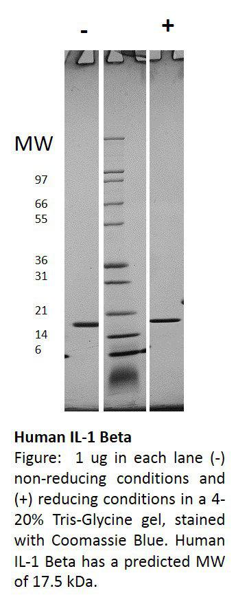 Human Interleukin-1 beta