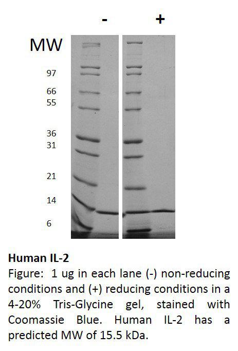 Human Interleukin-2