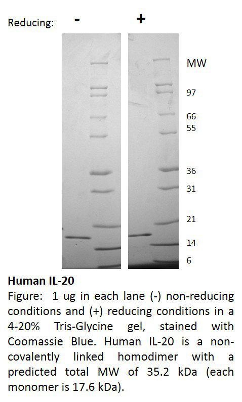 Human Interleukin-20