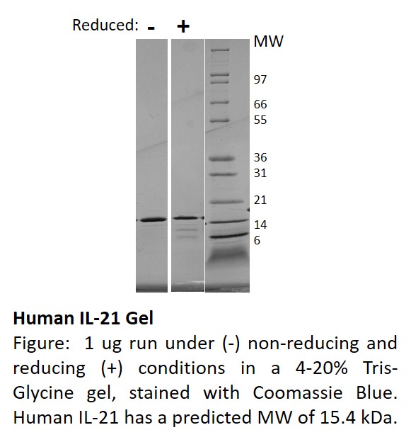 Human Interleukin-21