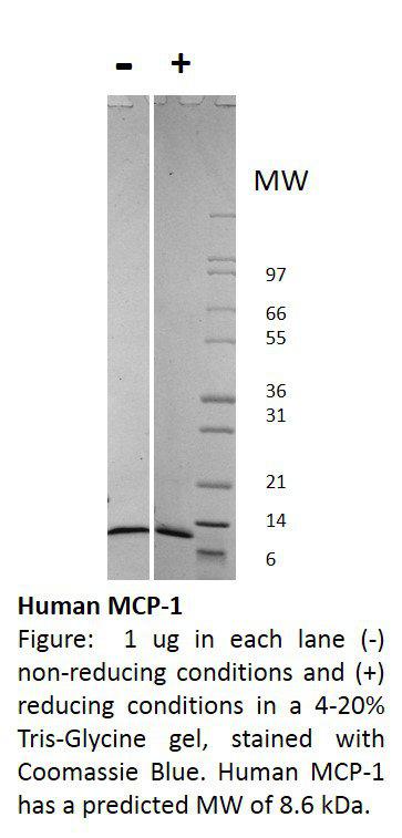 Human Monocyte Chemotactic Protein-1 (CCL2)