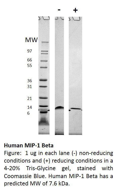 Human Macrophage Inflammatory Protein-1 beta (CCL4)