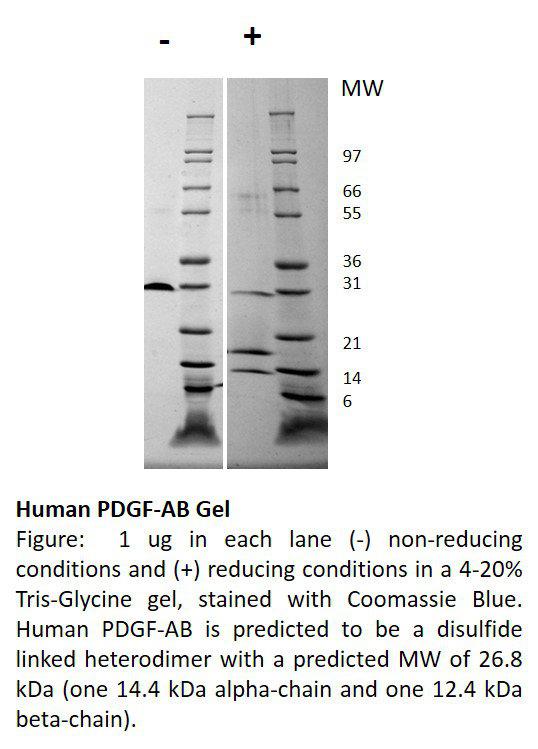 Human Platelet Derived Growth Factor-AB