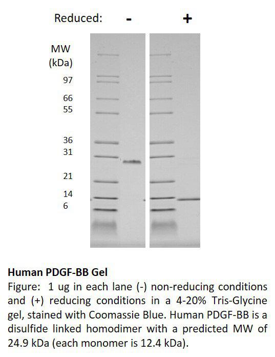 Human Platelet Derived Growth Factor-BB