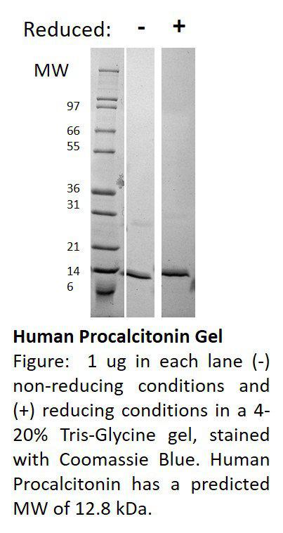 Human Procalcitonin